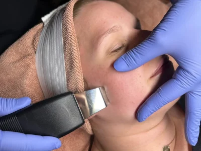 Ultrasonic Facials